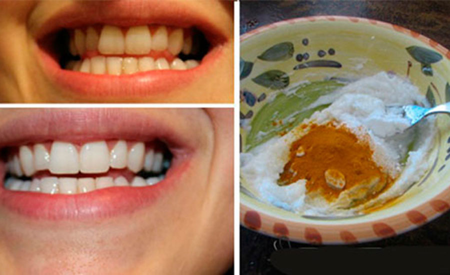 La pasta dental casera que blanquea dientes, previene caries y enfermedades  en las encías | Aweita La República